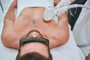 Man undergoing the laser chest hair removal