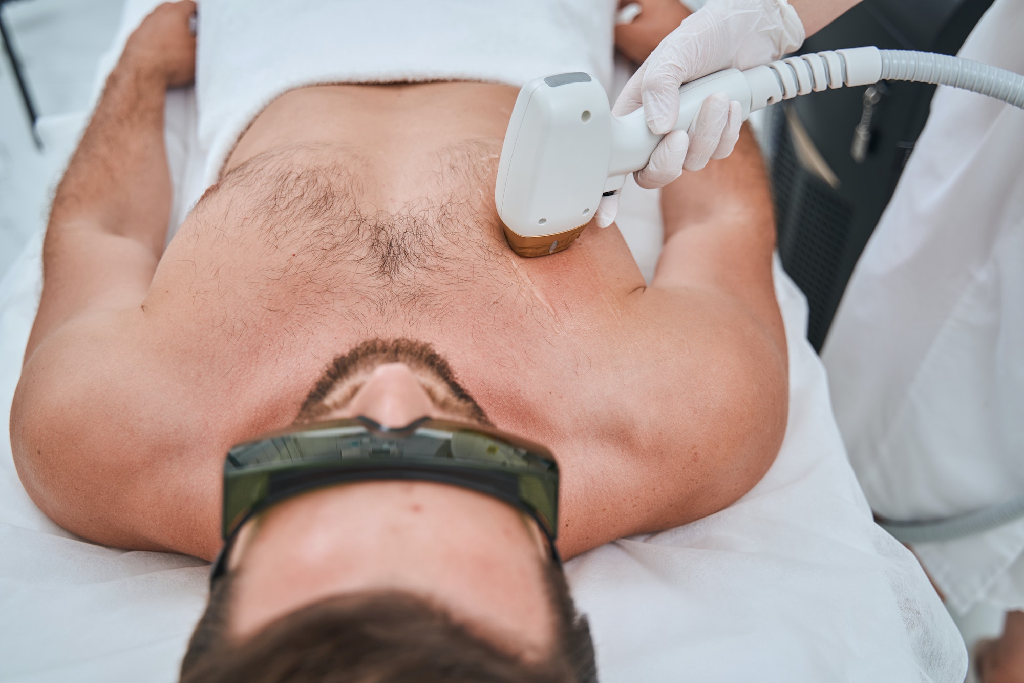 Man undergoing the laser chest hair removal
